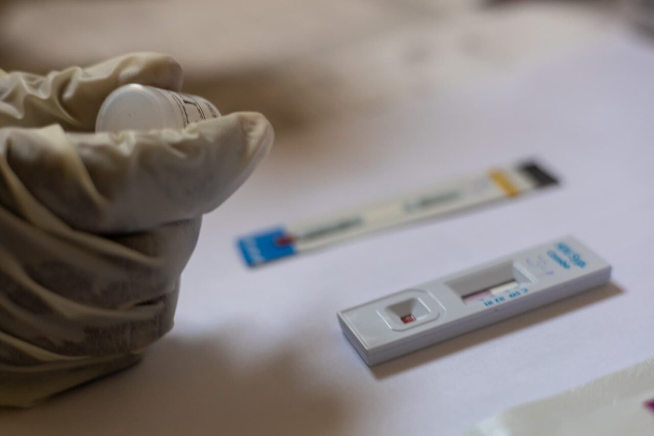 Syphilis Testing